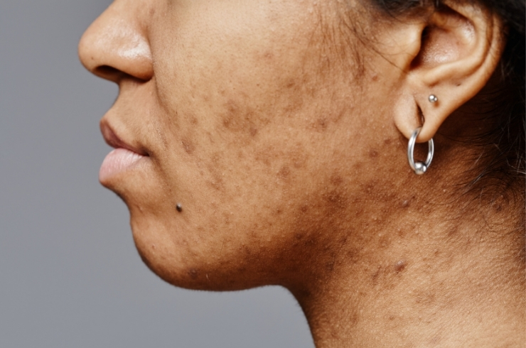 Saavy Skin & Diagnostics Centre