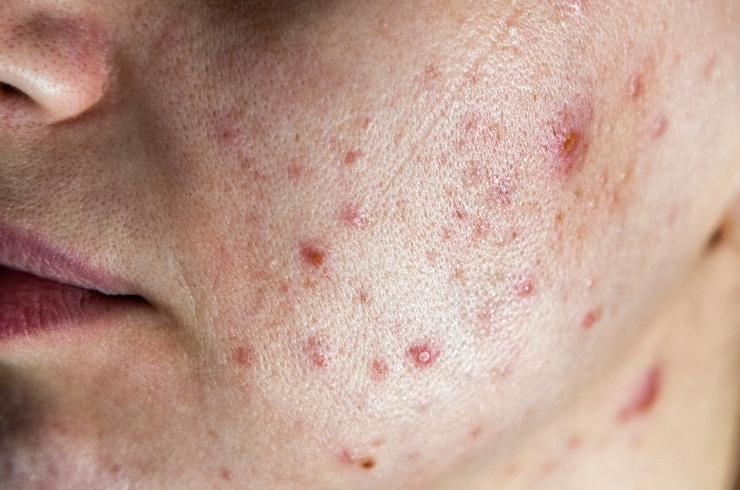 Saavy Skin & Diagnostics Centre
