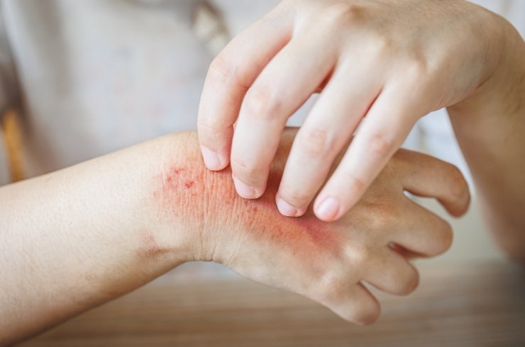Saavy Skin & Diagnostics Centre