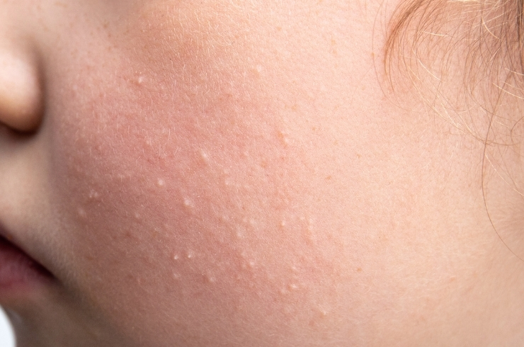 Saavy Skin & Diagnostics Centre