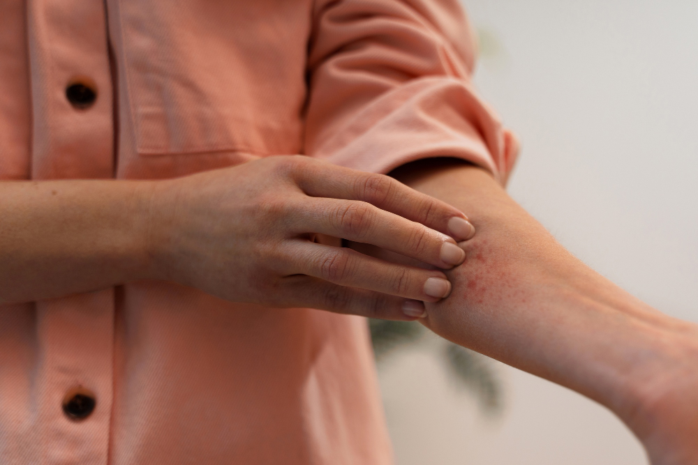 Recognizing a Ringworm Infection: Symptoms, Causes, and Diagnosis