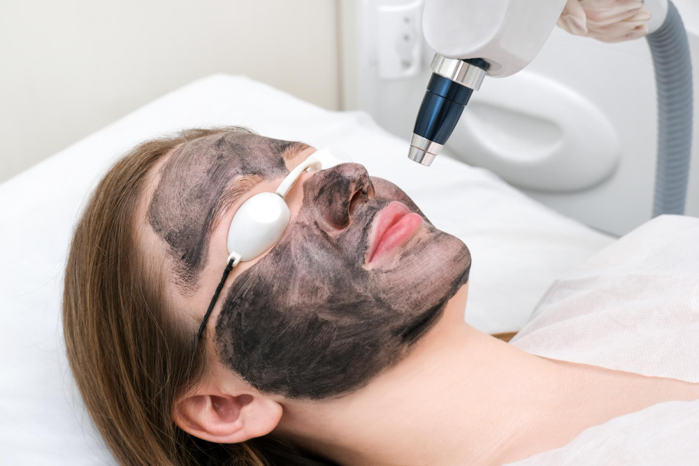 Carbon Peel Laser Facial: Benefits, Procedure, and What You Need to Know